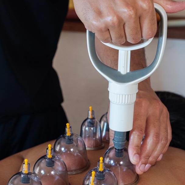 Terapia con ventosas
